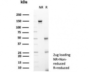 SDS-PAGE analysis of purified, BSA-free IL1RN antibody (clone IL1RA/4716) as confirmation of integrity and purity.