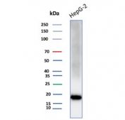 Western blot testing of human HepG2 cell lysate with IL1RN antibody. Predicted molecular weight ~20 kDa.