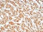 IHC staining of FFPE human adrenal gland tissue with Interleukin-1 beta antibody (clone IL1B/4651). HIER: boil tissue sections in pH 9 10mM Tris with 1mM EDTA for 20 min and allow to cool before testing.