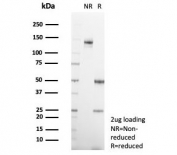 SDS-PAGE analysis of purified, BSA-free Interleukin-1 beta antibody (clone IL1B/4650) as confirmation of integrity and purity.
