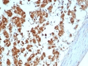 IHC staining of FFPE human adrenal gland tissue with Interleukin-1 beta antibody (clone IL1B/4650). HIER: boil tissue sections in pH 9 10mM Tris with 1mM EDTA for 20 min and allow to cool before testing.