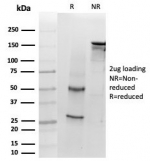 SDS-PAGE analysis of purified, BSA-free Interleukin-1 beta antibody (clone IL1B/463) as confirmation of integrity and purity.