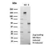 SDS-PAGE analysis of purified, BSA-free Interleukin-1 Beta (IL-1B) antibody (clone IL1B/4649) as confirmation of integrity and purity.