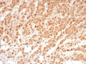 IHC staining of FFPE human adrenal gland tissue with Interleukin-1 Beta (IL-1B) antibody (clone IL1B/4649). HIER: boil tissue sections in pH 9 10mM Tris with 1mM EDTA for 20 min and allow to cool before testing.