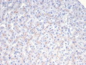 IHC staining of FFPE human liver tissue with BSEP antibody (clone BSEP/7534). HIER: boil tissue sections in pH 9 10mM Tris with 1mM EDTA for 20 min and allow to cool before testing.