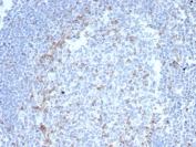 IHC staining of FFPE human tonsil tissue with Cytotoxic T-lymphocyte protein 4 antibody (clone CTLA4/6867R). HIER: boil tissue sections in pH 9 10mM Tris with 1mM EDTA for 20 min and allow to cool before testing.