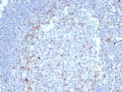 IHC staining of FFPE human tonsil tissue with Cytotoxic T-lymphocyte protein 4 antibody (clone CTLA4/6867R). HIER: boil tissue sections in pH 9 10mM Tris with 1mM EDTA for 20 min and allow to cool before testing.