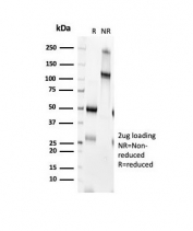 SDS-PAGE analysis of purified, BSA-free CD152 antibody (clone CTLA4/6868R) as confirmation of integrity and purity.