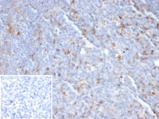 IHC staining of FFPE human tonsil tissue with CD152 antibody (clone CTLA4/6868R). Inset: PBS used in place of primary Ab (secondary Ab negative control). HIER: boil tissue sections in pH 9 10mM Tris with 1mM EDTA for 20 min and allow to cool before testing.