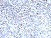 IHC staining of FFPE human tonsil tissue with CD152 antibody (clone CTLA4/6868R). HIER: boil tissue sections in pH 9 10mM Tris with 1mM EDTA for 20 min and allow to cool before testing.