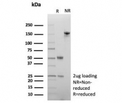 SDS-PAGE analysis of purified, BSA-free SATB2 antibody (clone SATB2/7488) as confirmation of integrity and purity.