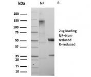 SDS-PAGE analysis of purified, BSA-free SATB2 antibody (clone rSATB2/8635) as confirmation of integrity and purity.