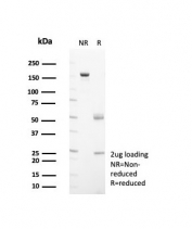 SDS-PAGE analysis of purified, BSA-free HSP60 antibody (clone HSPD1/8398R) as confirmation of integrity and purity.