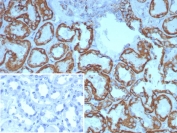 IHC staining of FFPE human kidney tissue with HSP60 antibody (clone HSPD1/8398R). Inset: PBS used in place of primary Ab (secondary Ab negative control). HIER: boil tissue sections in pH 9 10mM Tris with 1mM EDTA for 20 min and allow to cool before testing.
