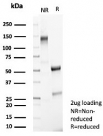 SDS-PAGE analysis of purified, BSA-free SATB2 antibody (clone SATB2/8292R) as confirmation of integrity and purity.