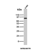 Western blot analysis of SATB2 antibody in K-562 cell lysate. A distinct immunoreactive band is observed at approximately 80-90 kDa, consistent with the predicted molecular weight of Special AT-rich sequence-binding protein 2. The rabbit monoclonal antibody clone SATB2/8877R demonstrates specific detection of endogenous SATB2 protein in denatured cell lysate under reducing conditions.