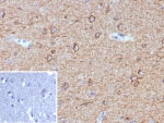 IHC staining of FFPE human brain tissue with MAP2 antibody (clone MAP2/7673). Inset: PBS used in place of primary Ab (secondary Ab negative control). HIER: boil tissue sections in pH 9 10mM Tris with 1mM EDTA for 20 min and allow to cool before testing.