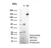 SDS-PAGE analysis of purified, BSA-free Carbamoyl-Phosphate Synthetase antibody (clone CPS1/8416) as confirmation of integrity and purity.