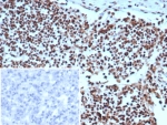 IHC staining of FFPE human lymph node tissue with XRCC5 / Ku86 / Ku80 antibody (clone XRCC5/7314). Inset: PBS used in place of primary Ab (secondary Ab negative control). HIER: boil tissue sections in pH 9 10mM Tris with 1mM EDTA for 20 min and allow to cool before testing.