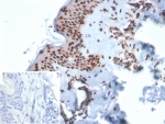 IHC staining of FFPE human skin tissue with XRCC5 / Ku86 / Ku80 antibody (clone XRCC5/7312). Inset: PBS used in place of primary Ab (secondary Ab negative control). HIER: boil tissue sections in pH 9 10mM Tris with 1mM EDTA for 20 min and allow to cool before testing.