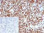 IHC staining of FFPE human lymph node tissue with XRCC5 / Ku86 / Ku80 antibody (clone XRCC5/7313). Inset: PBS used in place of primary Ab (secondary Ab negative control). HIER: boil tissue sections in pH 9 10mM Tris with 1mM EDTA for 20 min and allow to cool before testing.