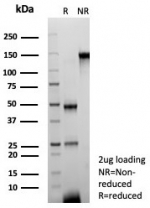 SDS-PAGE analysis of purified, BSA-free CPS1 antibody (clone CPS1/8420) as confirmation of integrity and purity.