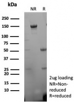 SDS-PAGE analysis of purified, BSA-free DES antibody (clone rDES/8846) as confirmation of integrity and purity.