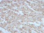 IHC staining of FFPE human smooth muscle tissue with DES antibody (clone rDES/8846). HIER: boil tissue sections in pH 9 10mM Tris with 1mM EDTA for 20 min and allow to cool before testing.