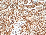 IHC staining of FFPE human lymph node tissue with Ku80 antibody (clone XRCC5/8093R). HIER: boil tissue sections in pH 9 10mM Tris with 1mM EDTA for 20 min and allow to cool before testing.