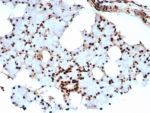 IHC staining of FFPE human salivary gland tissue with Ku80 antibody (clone XRCC5/8703R). HIER: boil tissue sections in pH 9 10mM Tris with 1mM EDTA for 20 min and allow to cool before testing.