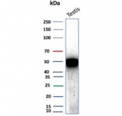 IHC staining of FFPE human testicular carcinoma tissue with INHA antibody (clone INHA/8872R) at 2ug/ml. HIER: boil tissue sections in pH 9 10mM Tris with 1mM EDTA for 20 min and allow to cool before testing.