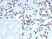 IHC staining of FFPE human kidney tissue with PET-1 antibody (clone FEV/7311). Inset: PBS used in place of primary Ab (secondary Ab negative control). HIER: boil tissue sections in pH 9 10mM Tris with 1mM EDTA for 20 min and allow to cool before testing.
