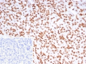 IHC staining of FFPE human pancreas tissue with PET-1 antibody (clone FEV/7311). Inset: PBS used in place of primary Ab (secondary Ab negative control). HIER: boil tissue sections in pH 9 10mM Tris with 1mM EDTA for 20 min and allow to cool before testing.