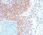 IHC staining of FFPE human tonsil tissue with PAX3 antibody (clone PAX3/8426). Inset: PBS used in place of primary Ab (secondary Ab negative control). HIER: boil tissue sections in pH 9 10mM Tris with 1mM EDTA for 20 min and allow to cool before testing.