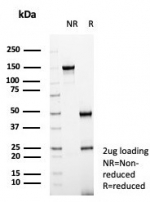 SDS-PAGE analysis of purified, BSA-free Nucleolin antibody (clone NCL/7337) as confirmation of integrity and purity.