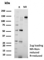 SDS-PAGE analysis of purified, BSA-free Nucleolin antibody (clone NCL/8695R) as confirmation of integrity and purity.
