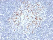 IHC staining of FFPE human lymph node tissue with PD1 (CD279) antibody (clone PDCD1/4231R). HIER: boil tissue sections in pH 9 10mM Tris with 1mM EDTA for 20 min and allow to cool before testing.