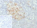 IHC staining of FFPE human tonsil tissue with PD1 (CD279) antibody (clone PDCD1/7276R). Inset: PBS used in place of primary Ab (secondary Ab negative control). HIER: boil tissue sections in pH 9 10mM Tris with 1mM EDTA for 20 min and allow to cool before testing.