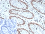 IHC staining of FFPE human colon tissue with MutL Homolog 1 antibody (clone MLH1/7562). HIER: boil tissue sections in pH 9 10mM Tris with 1mM EDTA for 20 min and allow to cool before testing.