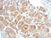 IHC staining of FFPE human salivary gland tissue with Catenin Beta antibody (clone CTNNB1/7759). HIER: boil tissue sections in pH 9 10mM Tris with 1mM EDTA for 20 min and allow to cool before testing.