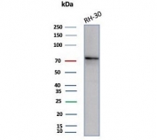 Western blot testing of human RH30 cell lysate with Catenin Beta antibody (clone CTNNB1/7759). Expected molecular weight: 85-95 kDa.