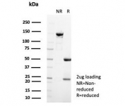 SDS-PAGE analysis of purified, BSA-free Catenin Beta antibody (clone CTNNB1/7759) as confirmation of integrity and purity.