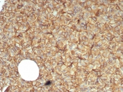 IHC staining of FFPE human pancreas tissue with Catenin Beta antibody (clone CTNNB1/7760). HIER: boil tissue sections in pH 9 10mM Tris with 1mM EDTA for 20 min and allow to cool before testing.