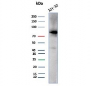 Western blot testing of human RH30 cell lysate with Catenin Beta antibody (clone CTNNB1/7760). Expected molecular weight: 85-95 kDa.