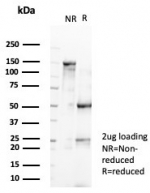 SDS-PAGE analysis of purified, BSA-free CTNNB1 antibody (clone rCTNNB1/8043) as confirmation of integrity and purity.