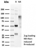 SDS-PAGE analysis of purified, BSA-free Beta Catenin (CTNNB1/6807R) as confirmation of integrity and purity.