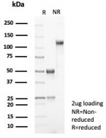 SDS-PAGE analysis of purified, BSA-free Beta-Catenin (CTNNB1/8280R) as confirmation of integrity and purity.