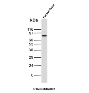 Beta Catenin Antibody Multi-Species Brain WB. Western blot analysis of brain tissue lysates from human, mouse, rat, hamster, guinea pig, and rabbit using Beta Catenin Antibody (clone CTNNB1/8280R) detects a consistent band at approximately 90-95 kDa across all species, aligning with the predicted molecular weight of Catenin beta-1 / CTNNB1 at ~85 kDa with a characteristic upward shift during SDS-PAGE. The conserved banding pattern supports cross-species detection of CTNNB1 and is consistent with phosphorylation-associated modulation of beta-catenin electrophoretic mobility in neural tissue.
