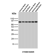 Beta Catenin Antibody Human Brain WB. Western blot analysis of human brain lysate using Beta Catenin Antibody (clone CTNNB1/8280R) detects a distinct band at approximately 90-95 kDa, consistent with the predicted molecular weight of Catenin beta-1 / CTNNB1 at ~85 kDa with a characteristic upward shift during SDS-PAGE. This migration pattern aligns with phosphorylation-associated modulation of beta-catenin and supports reliable detection of CTNNB1 in neural tissue.