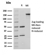 SDS-PAGE analysis of purified, BSA-free SATB1 antibody (clone SATB1/2661) as confirmation of integrity and purity.